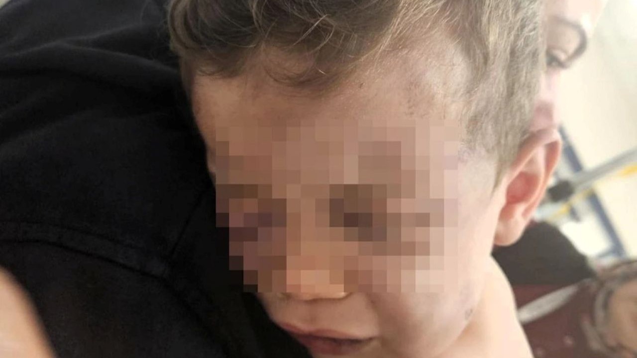 Denizli'de dehşet: 2 yaşındaki bebek darbedildi!