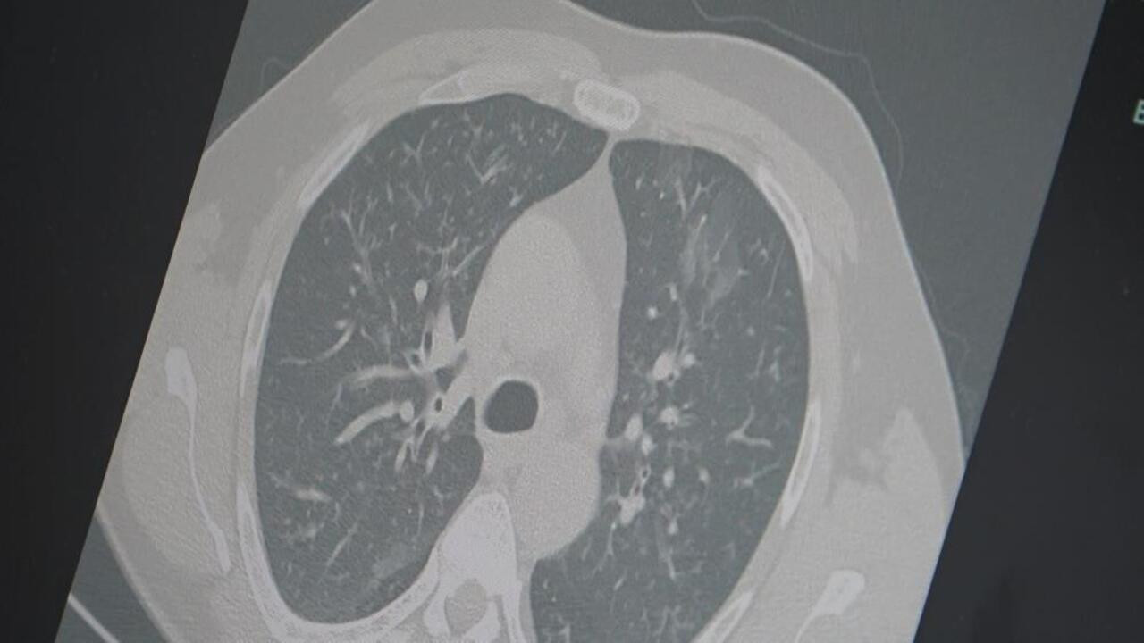 Profesör'den '3'lü salgın' uyarısı: 'Frankenstein varyantı' Türkiye'de!