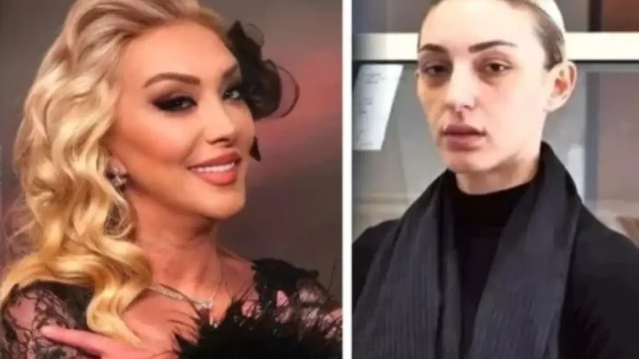 Güllü’nün ölümüyle ilgili şok iddia: “Bay bay deyip itti!”