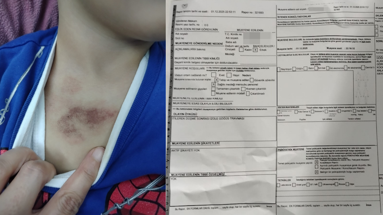 3 yaşındaki çocuğa istismar iddiası: İBB kreşi için adli süreç başladı