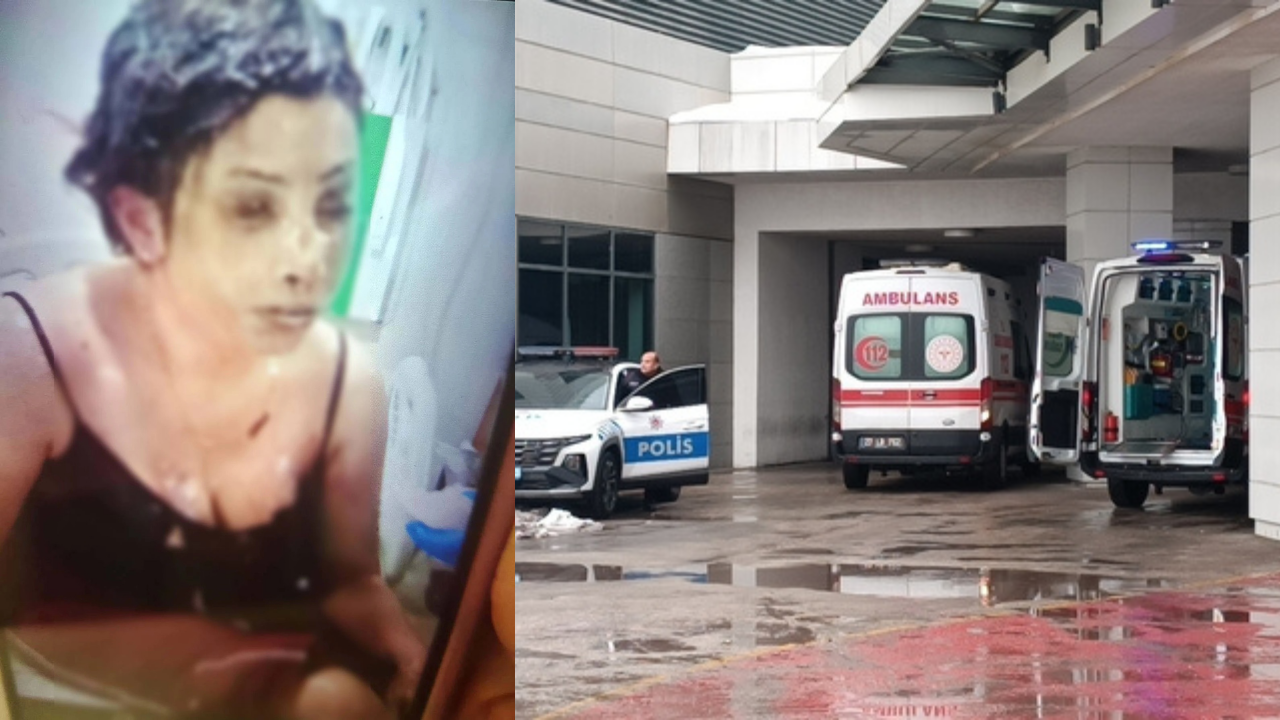 Boşanma aşamasındaki eşini koli bandıyla bağlayıp üzerine kezzap döktü