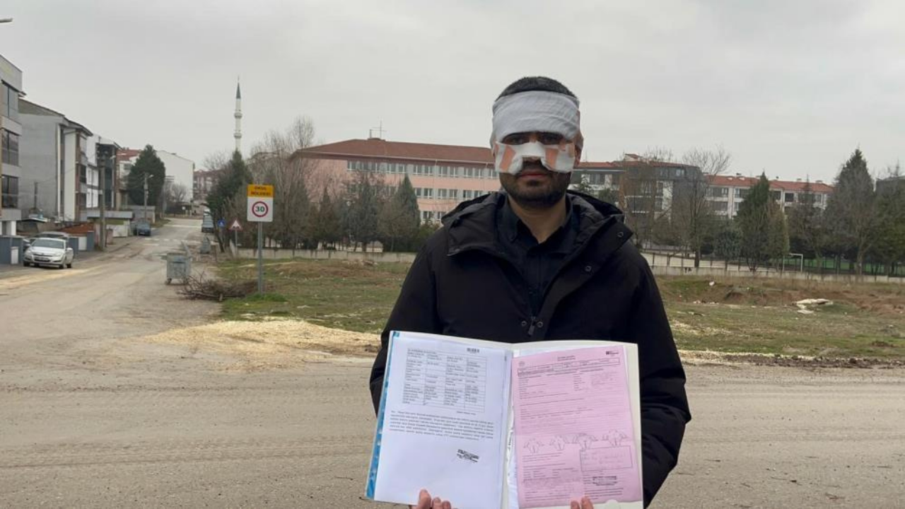 Meslektaşından akılalmaz zorbalık! Fizik öğretmeni feci şekilde yandı