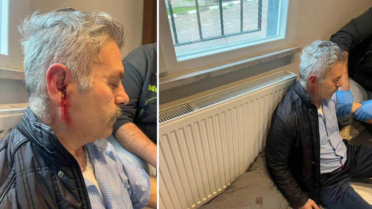 Çıkış işlemleri için çağırdıkları işçiyi darp ettiler: Hayati tehlikesi devam ediyor