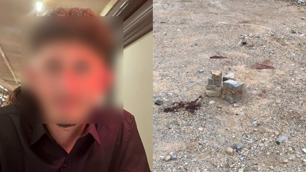 Ramazan topu yüzünde patladı: 19 yaşındaki genç ağır yaralı