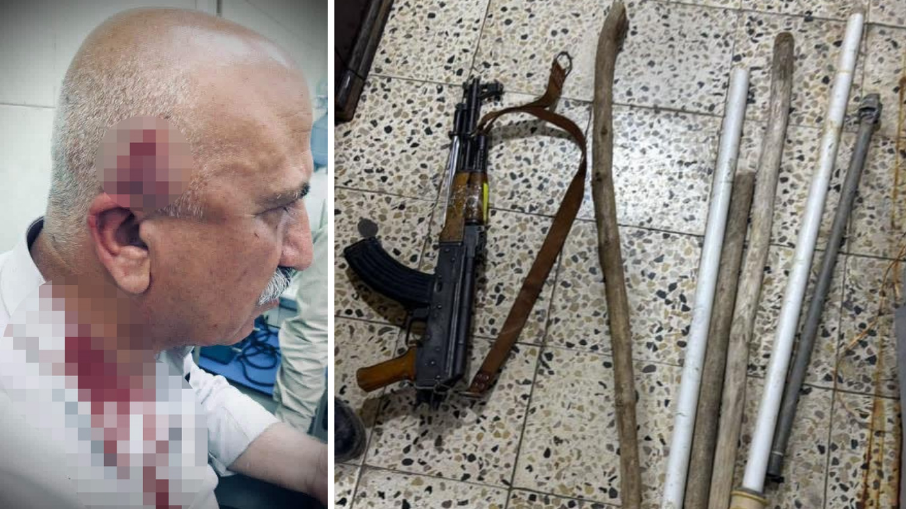 Kerkük Kaymakamı'na bıçaklı saldırı: Başından yaralandı