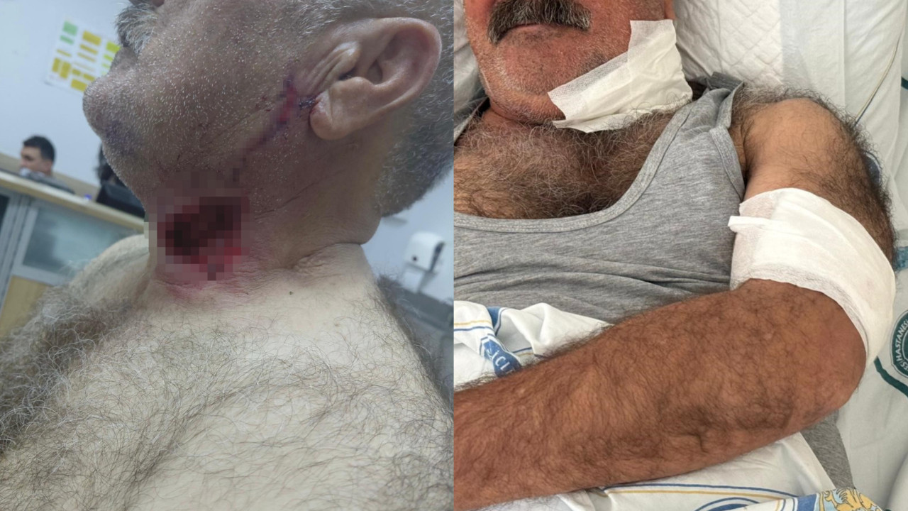 Diyarbakır’da at saldırısı: Kendi atı tarafından boğazından ısırılan kişi ağır yaralandı