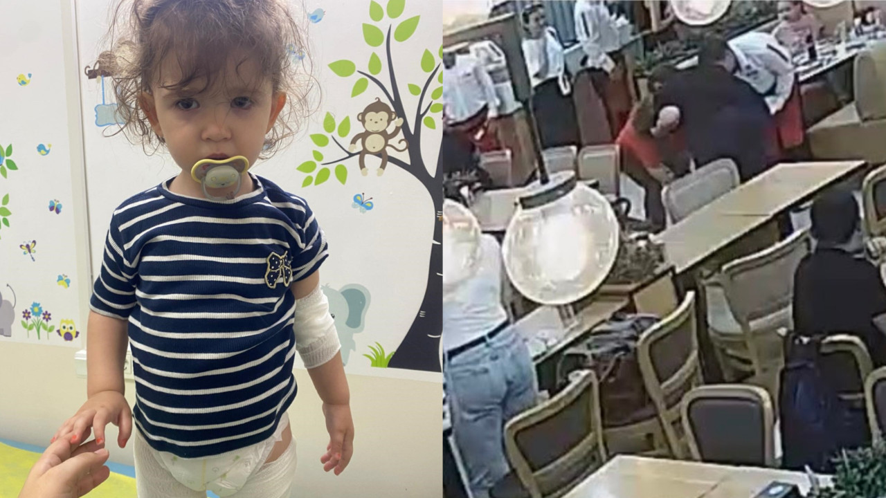 Restorandaki tereyağı şovu faciaya dönüştü: Kaynar tereyağı 