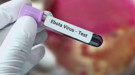 Ebola Virüsü Brezilya'ya mı sıçradı!