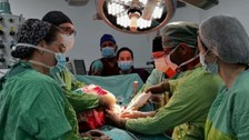 Karın ağrısı şikayetiyle hastaneye geldi, bakın karnından ne çıktı!
