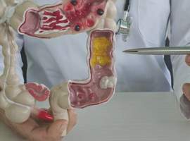 Ünlü oyuncu Murat Cemcir'i yoğun bakıma alan sinsi hastalık