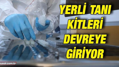 Yerli tanı kitleri devreye giriyor