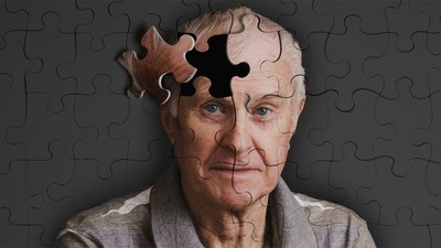 Alzheimer ilacı yararlımı- Alzheimer ilacı zararlı mı?
