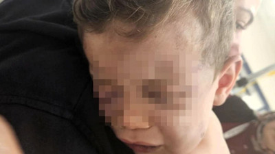 Denizli'de dehşet: 2 yaşındaki bebek darbedildi!