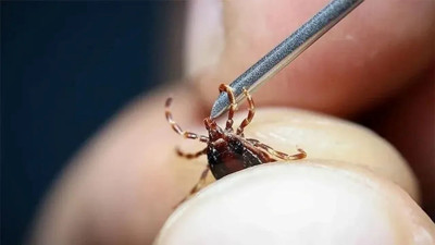 Kene alarmı! İstanbul'da aciller doldu, bakanlıktan kritik uyarı