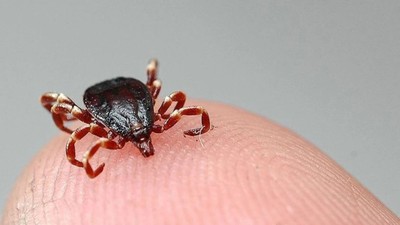 15 yaşındaki çocuk keneyi kendi çıkardı: Hastaneye sevk edildi