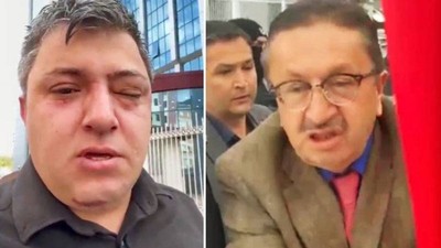 AK Partili Altındağ Belediye Başkanının darp ettiği memura bu kez de Ankara Adliyesi'nde işlem yaptırılmıyor