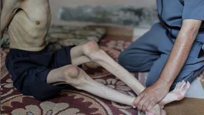 Gazze’de insani felaket: 106’sı çocuk 235 kişi açlıktan öldü