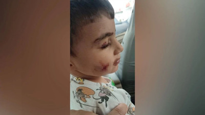 Sincan’da dehşet! Uyuyan çocuğu lağım faresi ısırdı