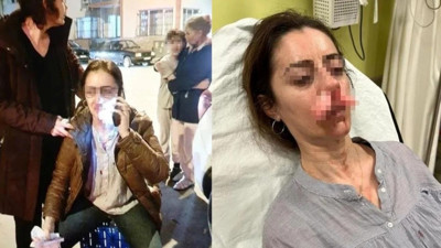 Edirne’de şok saldırı: Kadın, eşinin sevgilisine benzeyen kadını araba kapısıyla darbetti