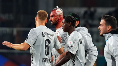 Başakşehir–Kocaelispor maçında korkutan anlar! Serdar Dursun kanlar içinde yerde kaldı