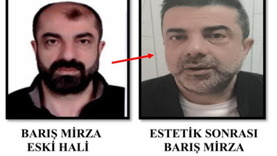 Film gibi kaçış! Yüzünü estetikle değiştiren firari zanlı 7 yıl sonra yakalandı