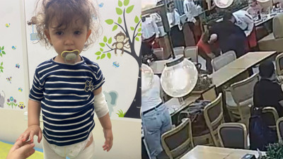 Kaynar tereyağı 2 yaşındaki bebeğin üzerine döküldü!