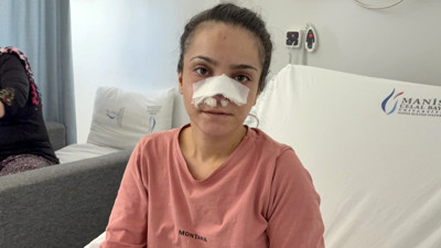 Alkollü eş dehşeti! Gözü dönmüş koca karısının burnunu ısırarak kopardı!