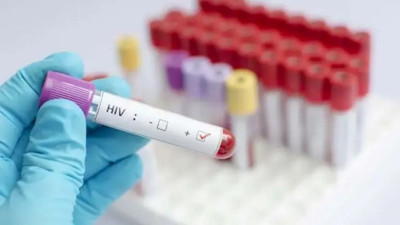 Korkutan salgın! HIV 'ulusal kriz' ilan edildi: Her 60 kişiden biri virüsü taşıyor