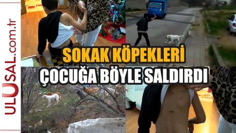 Pendik'te okula giden çocuğa sokak köpekleri böyle saldırdı