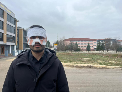 Meslektaşından akılalmaz zorbalık! Fizik öğretmeni feci şekilde yandı - Resim : 2