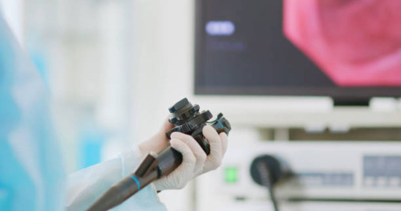 Gençlerde artan kolon kanseriyle ilgili çarpıcı bulgu: Suçlu aşırı işlenmiş gıdalar olabilir - Resim: 5