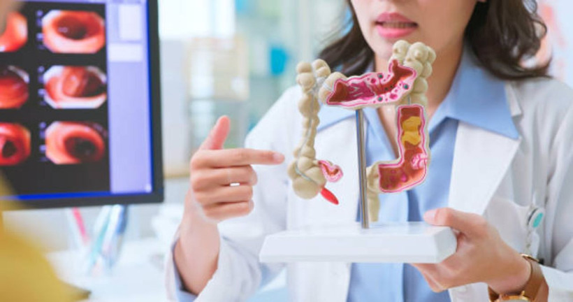 Gençlerde artan kolon kanseriyle ilgili çarpıcı bulgu: Suçlu aşırı işlenmiş gıdalar olabilir - Resim: 4