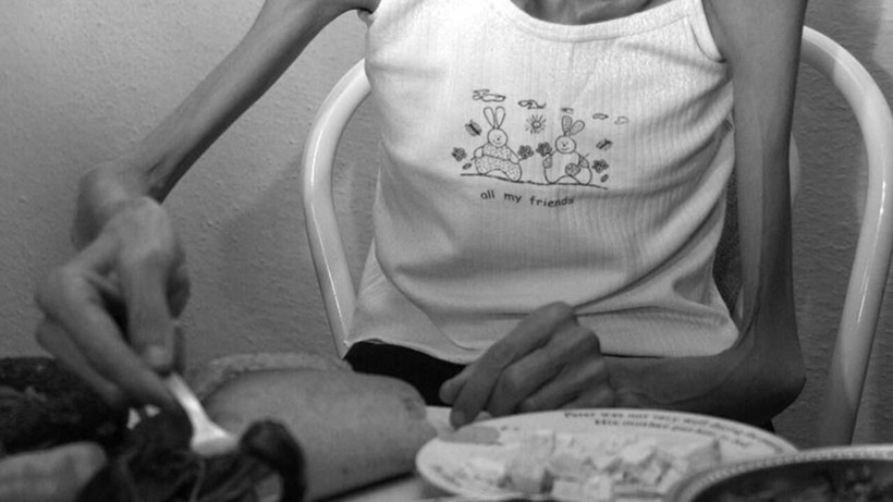 Anoreksiya Nervoza nedir? Belirtileri ve tedavi süreci nasıldır? - Resim: 2
