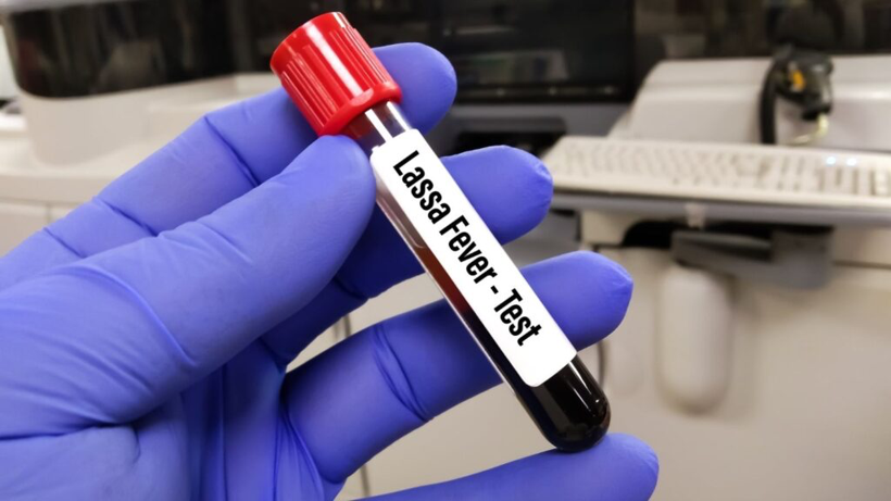 Kanamalı ateşle başlayan salgın korkutuyor: 162 can kaybı - Resim: 4