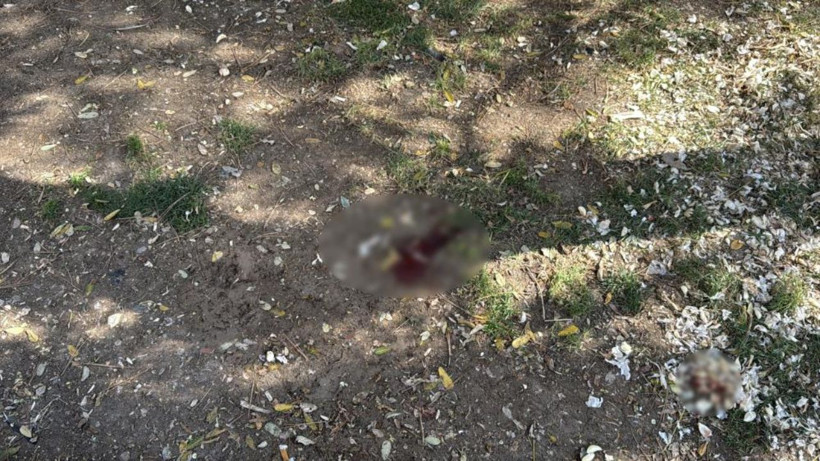 Parkta oturuyordu, döner bıçaklı saldırıya uğradı! Eskişehir’de dehşet anları - Resim: 4