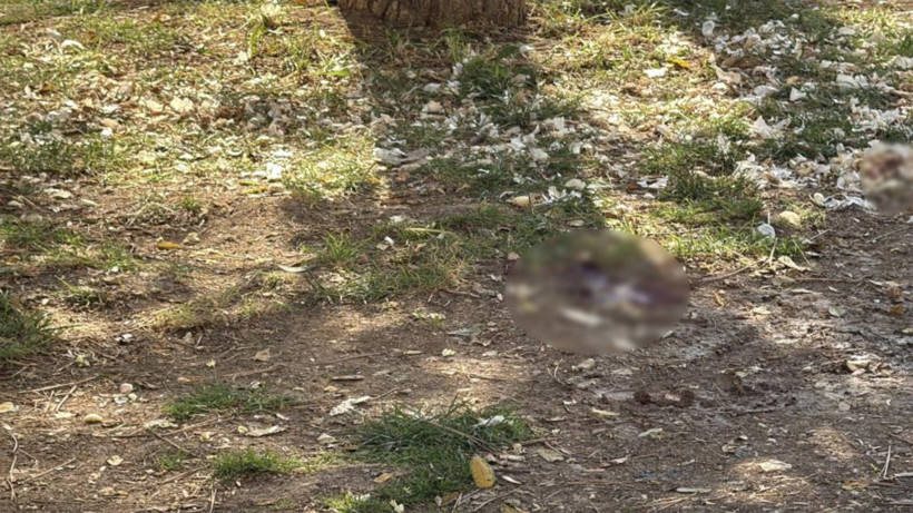 Parkta oturuyordu, döner bıçaklı saldırıya uğradı! Eskişehir’de dehşet anları - Resim: 3