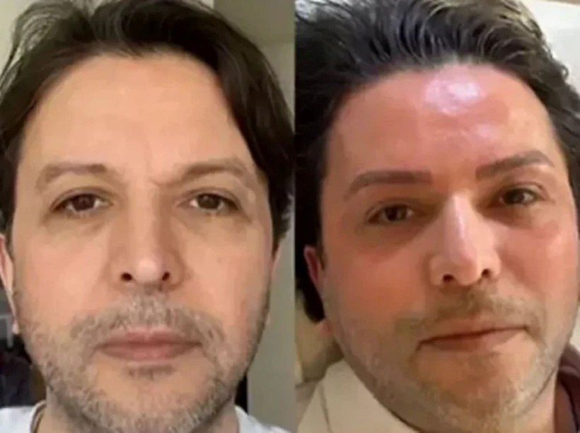 Nihat Doğan'ın yeni hali olay oldu: Görenler tanıyamadı - Resim : 1